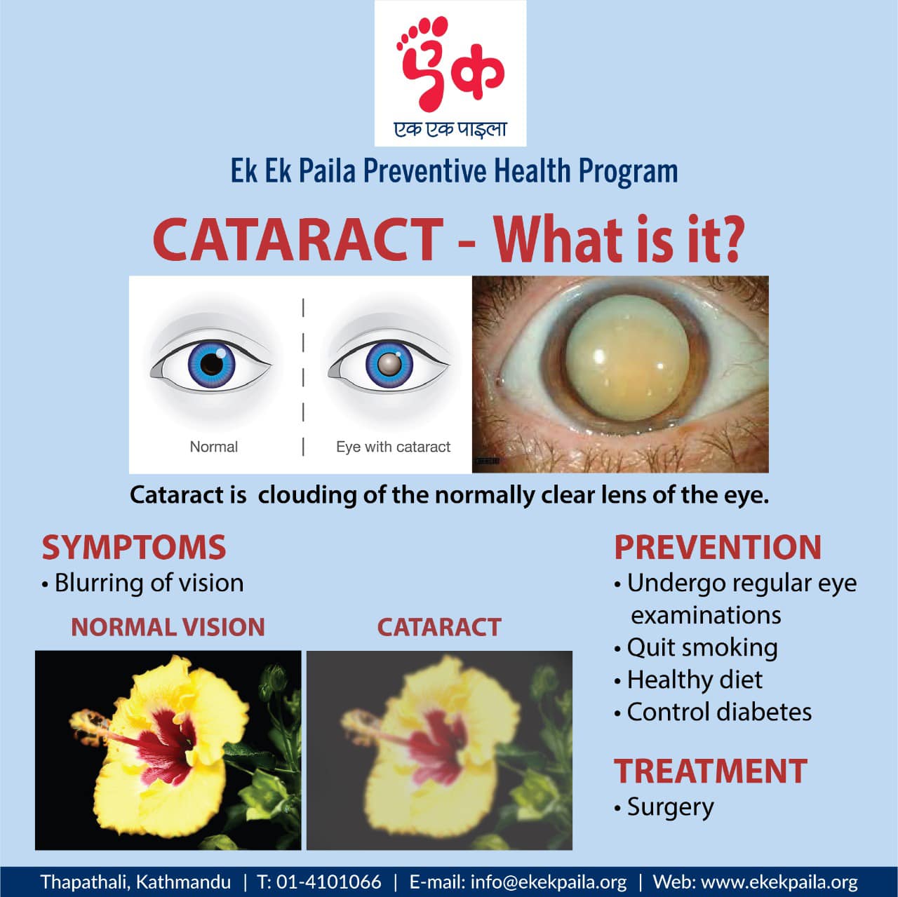 Cataract - what is it ?